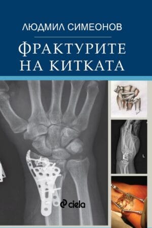 Фрактурите на китката